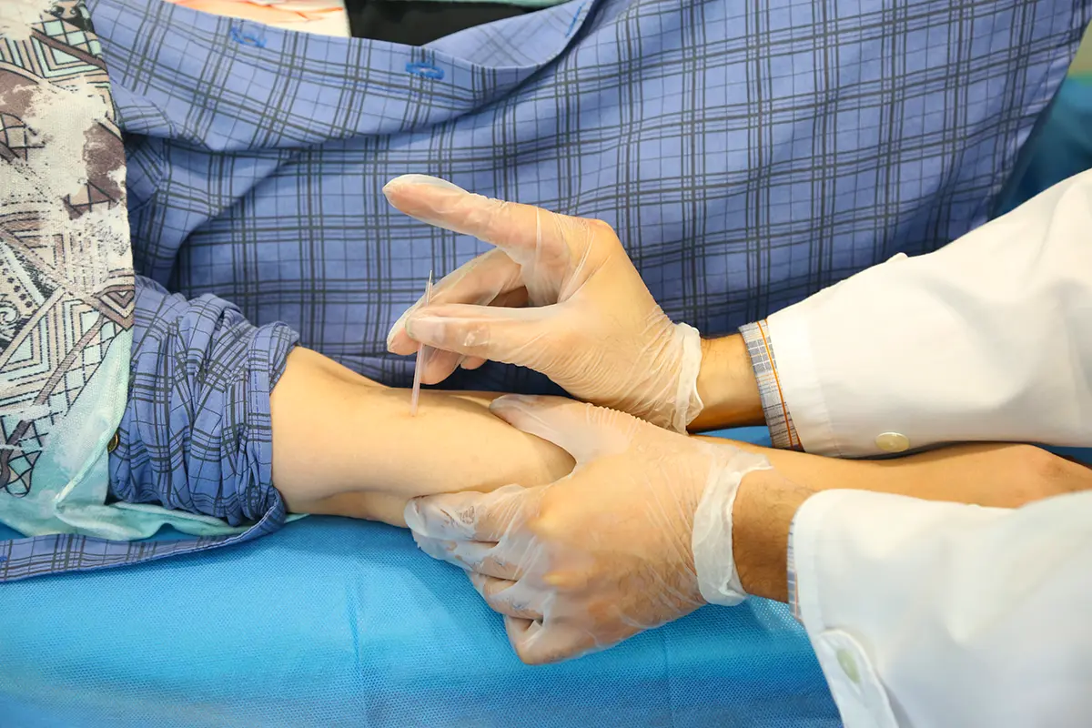 درای نیدلینگ